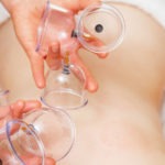 Massage therapist preparing for cupping therapy on the back.